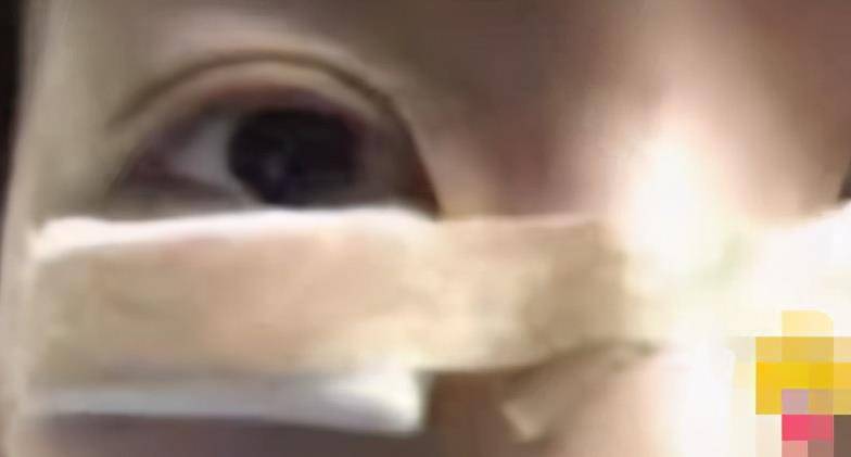 网曝孙一宁整容照片，疑似整容前后判若两人，还被前男友曝黑料